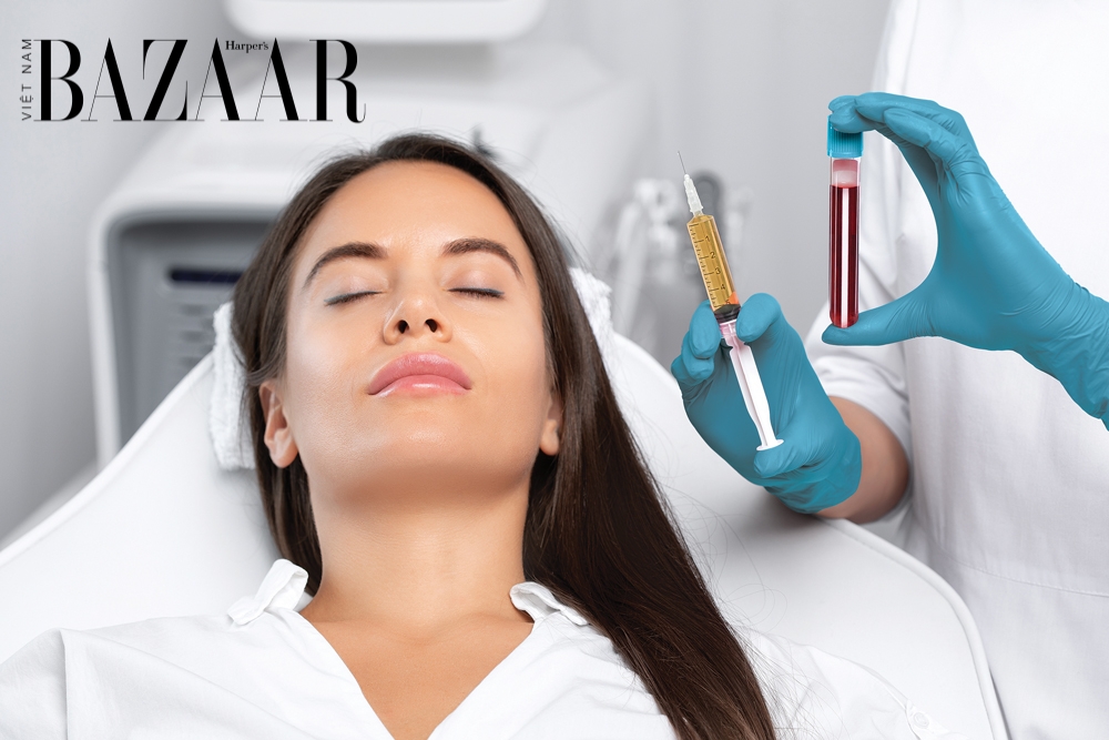 Các phương pháp trị rụng tóc mãn tính hiệu quả bạn cần biết – tiêm tiểu cầu PRP