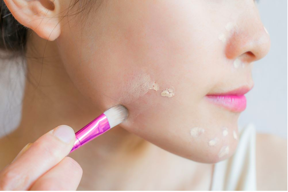 Cách che vết thâm tạm thời