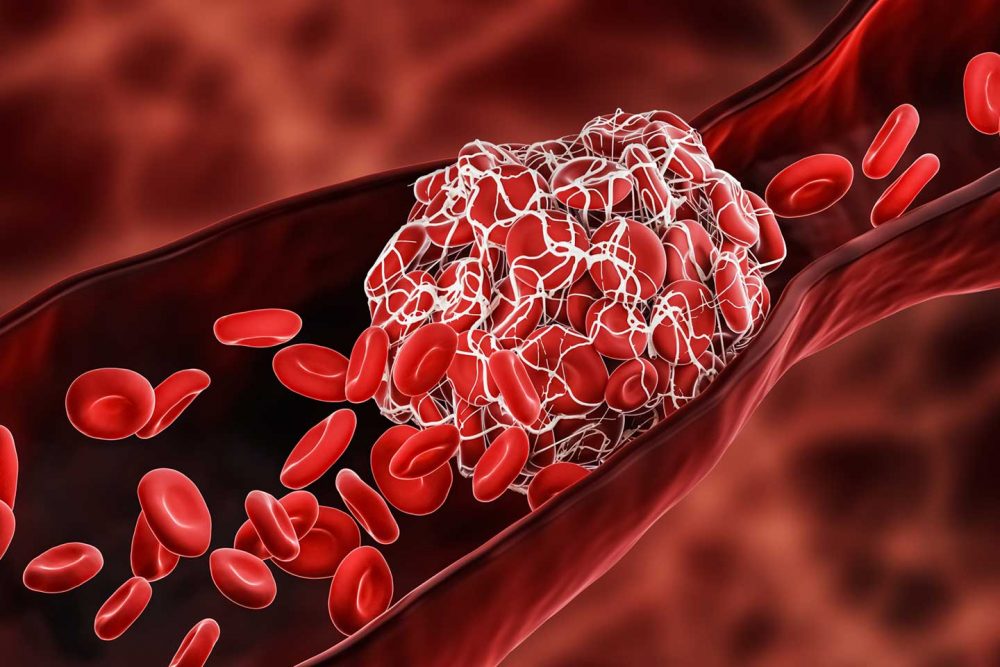 Cải thiện mức độ cholesterol