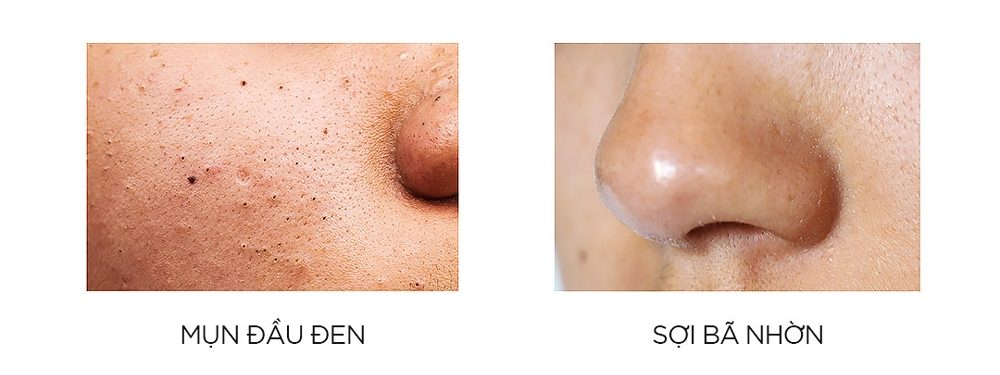 BZ-soi-ba-nhon-va-mun-dau-den-1