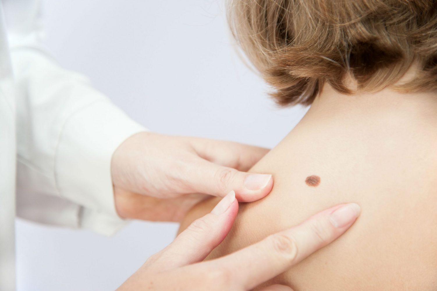 Các vị trí nốt ruồi trên lưng phụ nữ khác