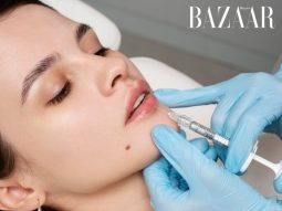 Tia UV ảnh hưởng tiêu cực đến tiêm filler