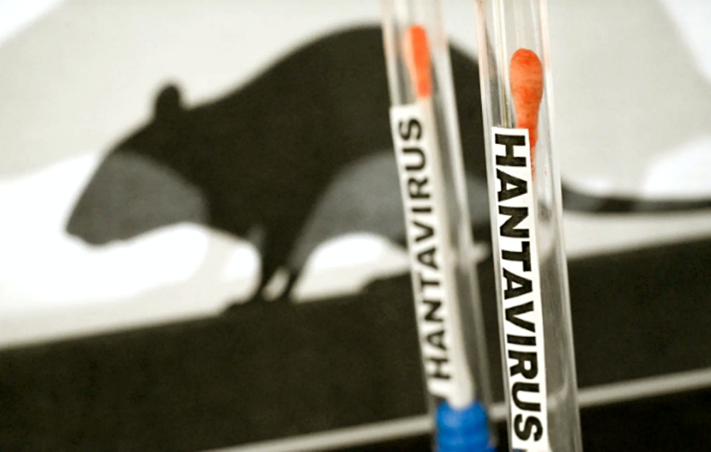 Các triệu chứng nhiễm hantavirus Các triệu chứng nhiễm hantavirus